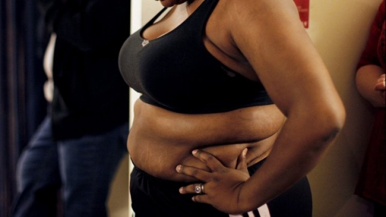 Obesity rising among Rwandans with more women affected: survey